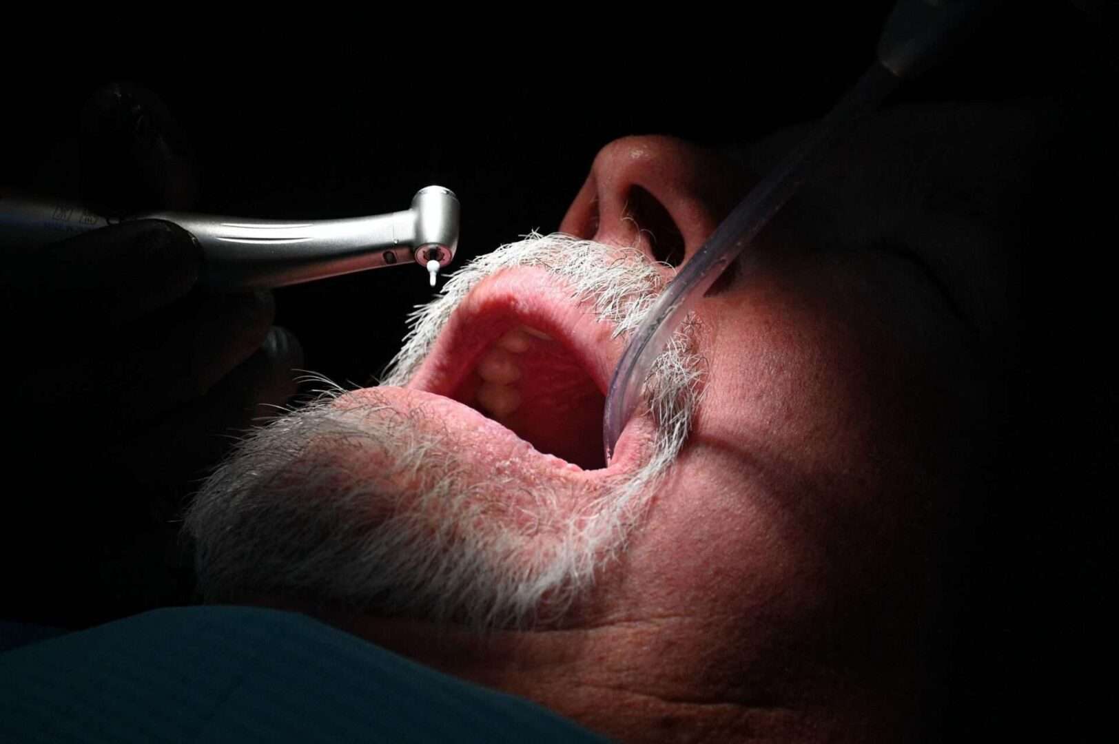 While Medicare Advantage plans lure customers with television ads promising plans with dental, vision and hearing benefits that traditional Medicare doesn’t offer, critics say the actual value of those benefits to enrollees is questionable,  with many finding they have to still pay significant amounts out of pocket. 